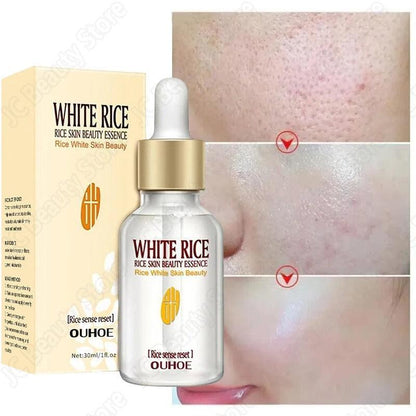 White Rice Whitening Serum & Moisturizing Cream - Anti-Aging, Anti-Wrinkle, Acne Treatment & Skin Brightening - VIZMO