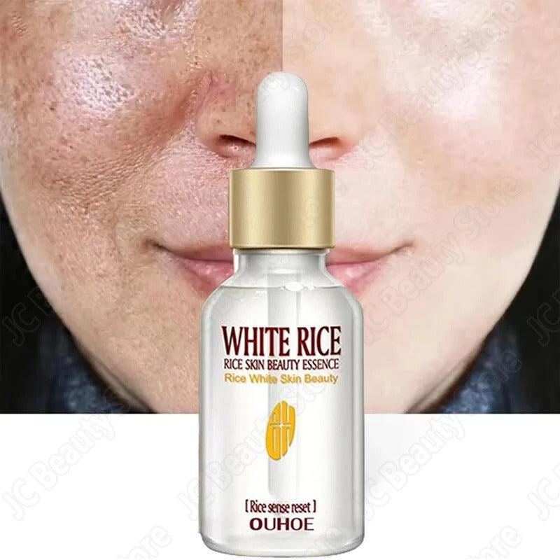 White Rice Whitening Serum & Moisturizing Cream - Anti-Aging, Anti-Wrinkle, Acne Treatment & Skin Brightening - VIZMO